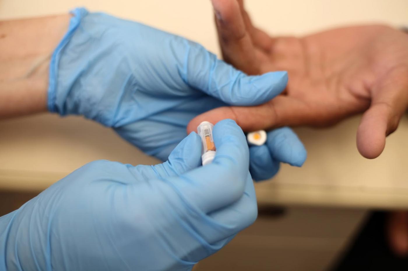 Julho Amarelo reforça testagem gratuita e vacinação contra hepatites B e C